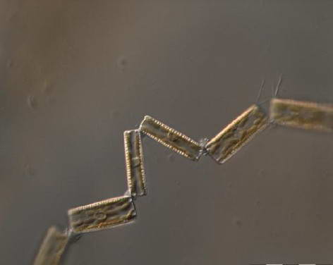 Diatoma vulgaris Bory de Saint-Vincent